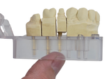 Diamond Articulator Pin Cap Removal Tool