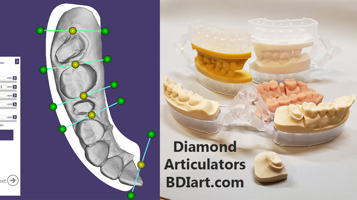 Model Build 3shape 3D Printed Model Library for Exocad Model Creator and 3Shape Model Bui ...